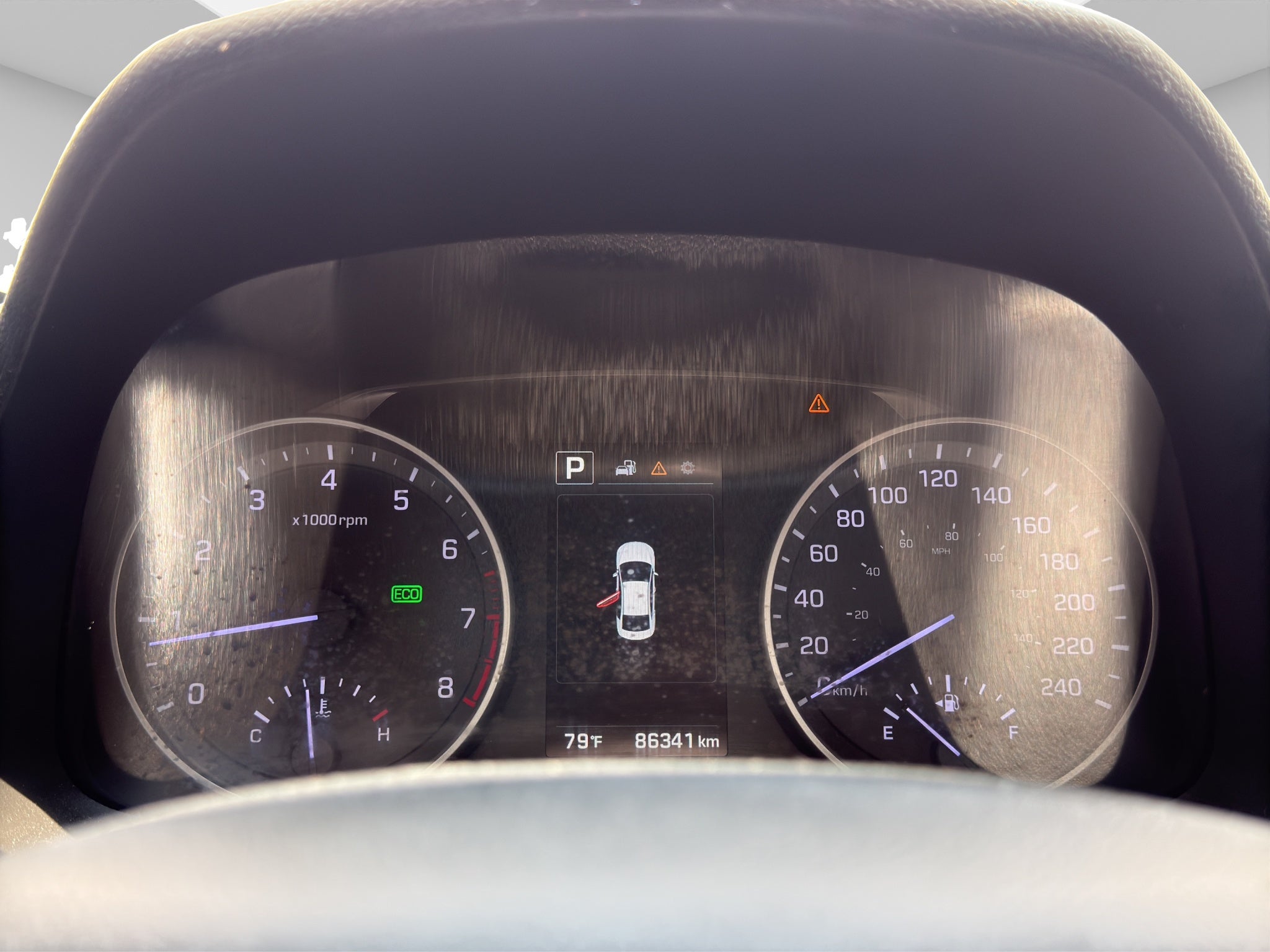 2017 Hyundai Elantra 2.0 Limited Tech Navi At