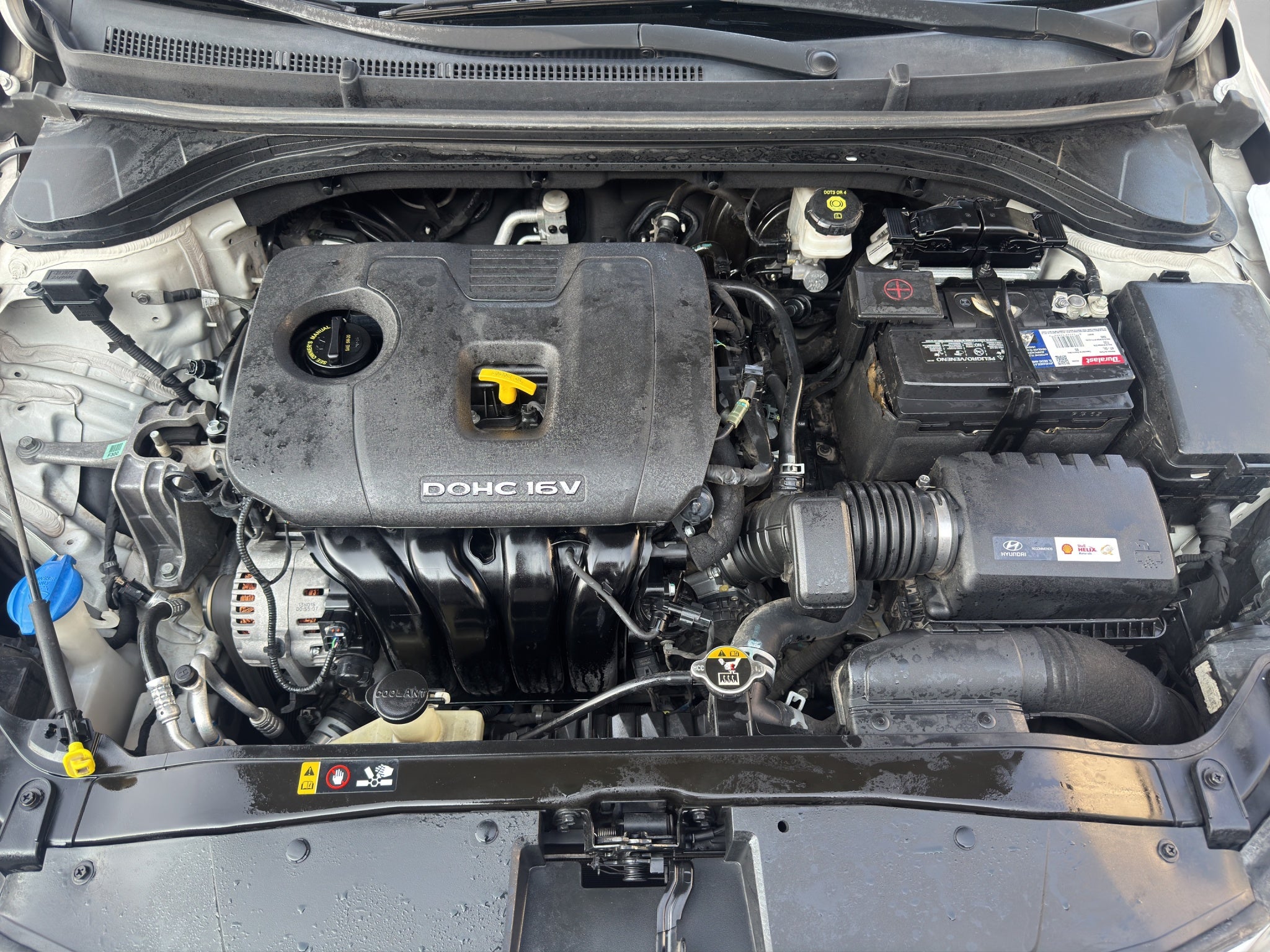 2017 Hyundai Elantra 2.0 Gls Premium At